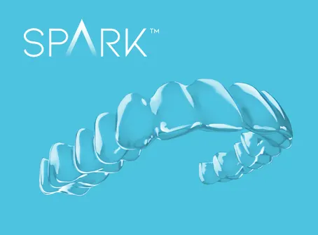 Gutieră transparentă Spark™ Clear Aligners, cu sigla Spark™, pe fundal albastru